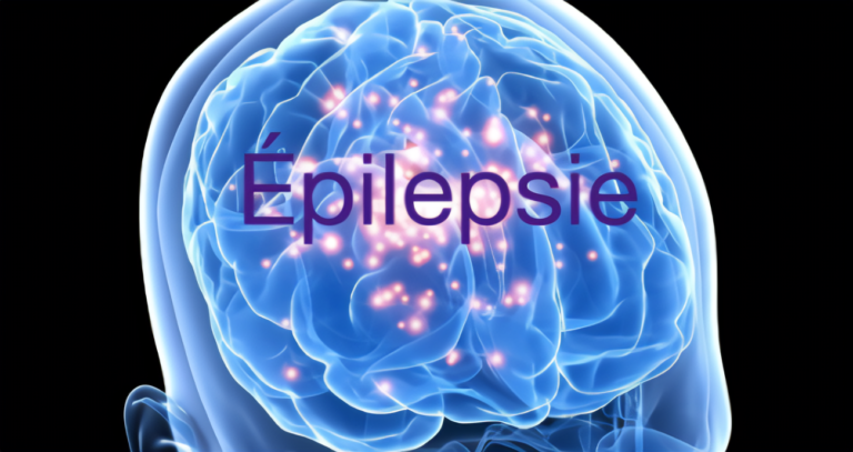 Cannabinoids in the Treatment of Epilepsy